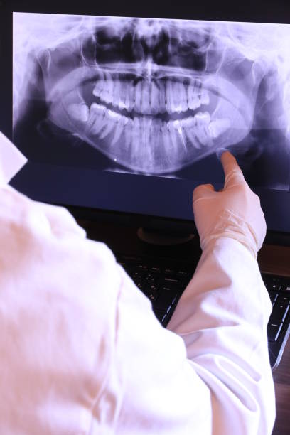Best Emergency Treatment for Dental Infections or Abscesses in Carlton, OR