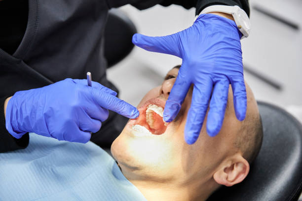 Best Emergency Denture Repair in Carlton, OR